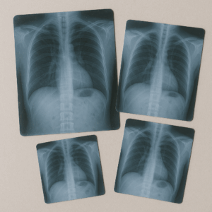Used x-ray film